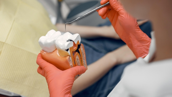 Pentingnya Perawatan Endodonti yang Perlu Anda Ketahui